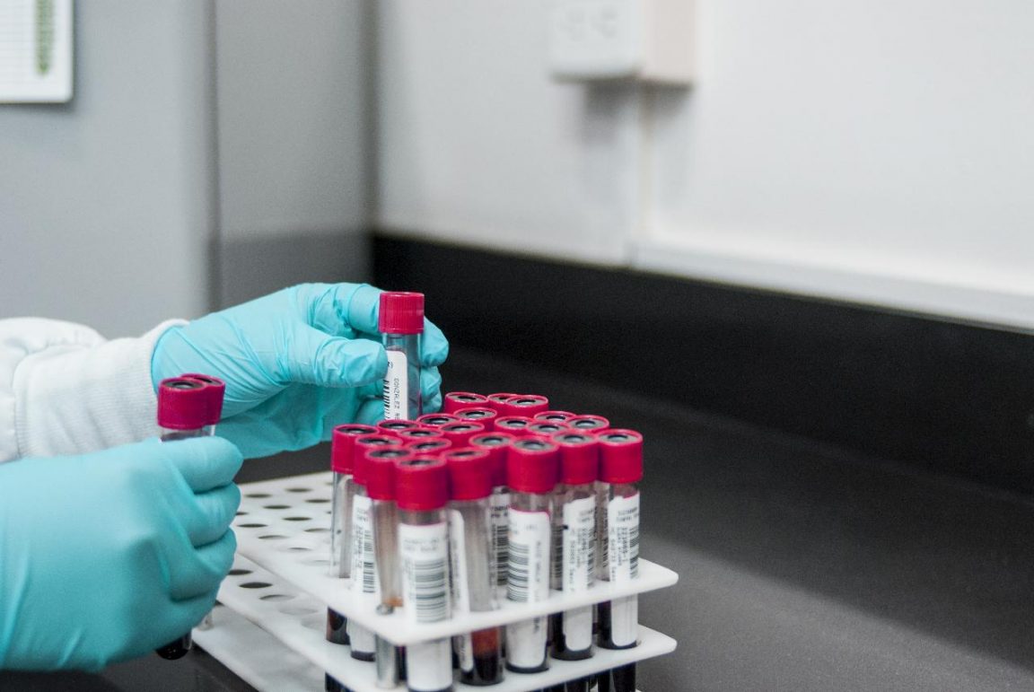 Biosorveglianza