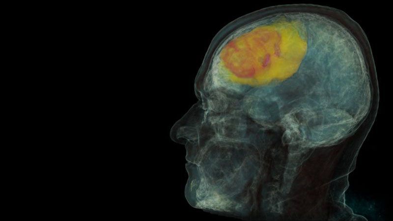 intelligenza artificiale medicina