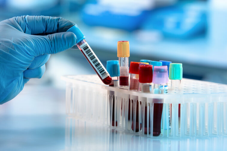 analisi del sangue